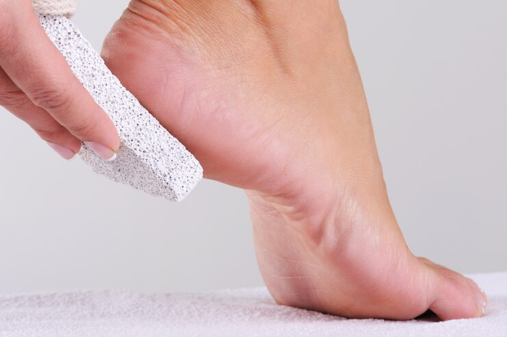 Cracked Heels: 10 Simple Tips for Pampering Your Feet